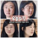 대전예술고등학교 | 대전 윤곽관리 내돈내산 오늘스킨 2차 후기 | 대전 웨딩관리 추천
