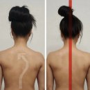 남구-115 | 울산 피부관리 남구 삼산동 아뜰리에드스킨 라운드 숄더, 비대칭 후기