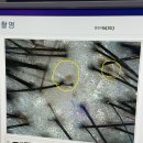 하울팟 부산케어센터 | 부산두피관리 웰킨두피탈모센터 부산대점 가려운 건성두피케어후기