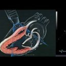 심장 초음파 검사 금식 시간 가슴 초음파 통해 알 수 있는 건 이미지
