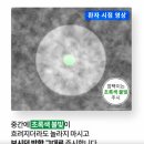 닥터미소의원 | 눈에미소안과의원 스마일라식 당일수술 후기 /경도근시 /지인할인