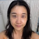 북아현동 주민센터 | [라르본뷰티] 속광이 차오르는 피부 만들기 성공! 손맛이 제대로인 신촌피부관리 찐 후기