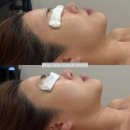 보다 더 에스테틱(Boda the Aesthetic) | 아프지 않은 대구 리프팅 관리, 대구피부관리 대구윤곽관리 함께 가능한, 대구에스테틱 브이에스테틱