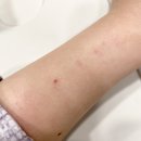 [출산일기] 검단 더나아산부인과 제왕절개 3일차