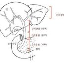 담도/담낭암 이미지