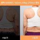 엔슬림의원 이미지