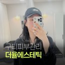 구디피부관리 더율에스테틱, 라운드숄더 관리 후기