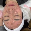 온기뷰티 - 부산진구 | 부산피부관리 서면피부관리 부산피부 온기뷰티 젤리팩 후기