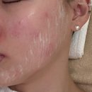메트로펠리스3 | 대전 여드름 압출 잘하는곳 [오와스킨] 에서 피부관리 받은 후기 추천 👍🏻