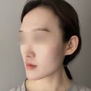 달리아에스테틱(목동점) | 목동피부관리 달리아 에스테틱 목동점 효과빠른 작은얼굴 관리 후기