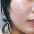 리프테라피 | 대구마사지맛집 40대 윤곽관리 리프테라피