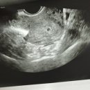 아이소망 산후조리원 이미지