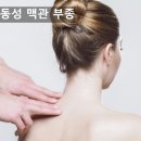 진동성 이미지