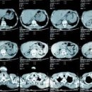 복부 CT MRI 초음파 검사 통해 알 수 있는 건 이거죠 (금식 물 조영제 시간) 이미지