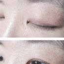 아이모네일 이미지