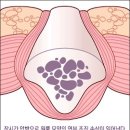 ▣ 입원으로 인한 활동보조 급여 중단 시정해야 ▣,오산 시각장애인,시각장애인 체육대회,장애인 심부름센터,장애인 활동보조,참사랑노인회, 참사랑후원회 이미지