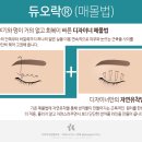매몰법후기 내맘속에 저장 하고픈 쌍커풀