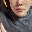 솔케어 | 평촌역 에스테틱 솔에스테틱 시그니처 앰플케어 피부관리 후기