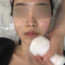 서울 신림동 | 신림 피부관리 에스테틱여운 X스케일링 후기