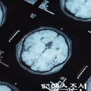 ‘의사·기자·환자’가 추천하는 파킨슨병 名醫를 찾아라 이미지