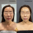 어썸테라피 이미지