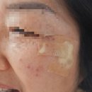 동백약국 | [공지] 부산 양정 봄한의원 흑자제거비용 기미제거 내돈내산/동백전사용/주차장(+후기추가)