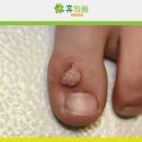 휴의원 네이버블로그