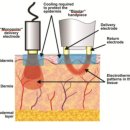 The Infini 이미지