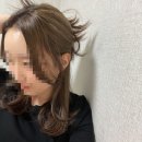 20대 여자 원형탈모 치료 완치 후기, 머리카락 자라는 과정 리얼후기