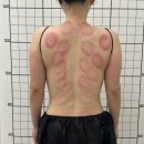 더뉴바디스미스 | 김포 다이어트관리 추천 뷰티온 더뉴바디 등관리 후기