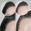 햇빛헤어라인 - 북구 | 햇빛헤어라인