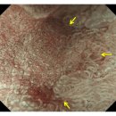 동대구내과의원 | 신암동 동대구역 위내시경) 소화기내과 전문의가 꼼꼼하게 진행하는 위암 검진