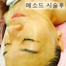 예쁘제에스테틱