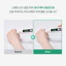 마디손병원 | 손가락마디통증 집에서 관리한 하루미담 파라핀베스 후기