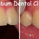 동그라미 치과기공소 이미지