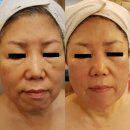 에스에이치메디칼 이미지