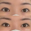 대구덕성초등학교 | 대구 동대구역 신암동속눈썹연장 눈이 편한 아소뷰티