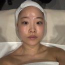 채움올림에스테틱 | [천안성성동] 채움올림 | 채움올림에스테틱-작은얼굴윤곽관리받고온후기🖤(Before/After)