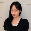 눈피부과의원 | 신논현역 피부과의원 세르프리프팅 300샷 전후 후기, 시술대상, 세르프 당일 통증, 일주일 후기