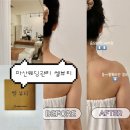 마산합포구 ⓘ-8 | 마산피부관리 쎌뷰티｜드레스라인 끝판왕 RSPT 라운드숄더 관리 리얼후기