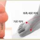 아치날 이미지