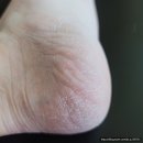 닥터씨 발각질 3총사 정직한 사용후기