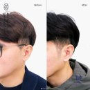 탈모왕 광주점 이미지