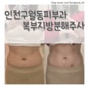 블리핏 | 인천구월동피부과 복부지방분해주사 블리핏 1회차 통증 효과 솔직후기