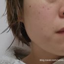 주식회사 바이오나인 | [ 비타민세럼 비타민앰플 ] 제이시아 리얼비타나인 사용후기 : 세럼추천 앰플추천