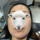 손주약국 | 내돈내산 리쥬란 부작용 후기 / 피멍 / 쥬베룩 / 손주사