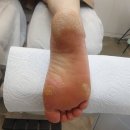 푸스케어대전신탄진점 네이버블로그