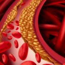 휘트니스A 이미지