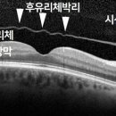 경희미한의원 네이버블로그