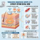 온열건강과학 이미지